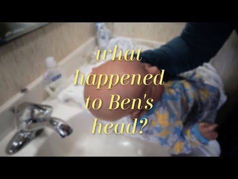 STOP Using Diapers On Your Reborn Baby's Head! What Happened to Ben & How I Fixed it!