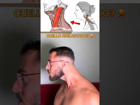 Vas a aprender a corregir el cuello adelantado