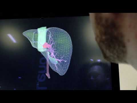 Detect Cancer Faster with AI Demo at Lenovo Transform