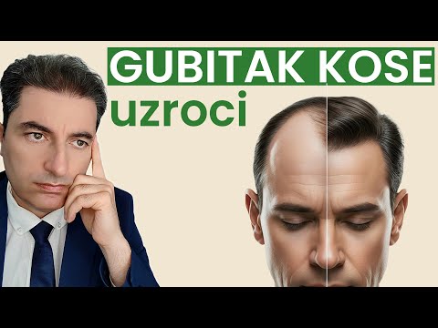 Koji je glavni razlog gubitka kose?