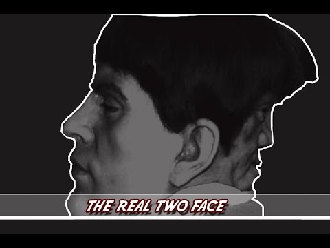 TWO FACE - An affliction with the strangest twist
