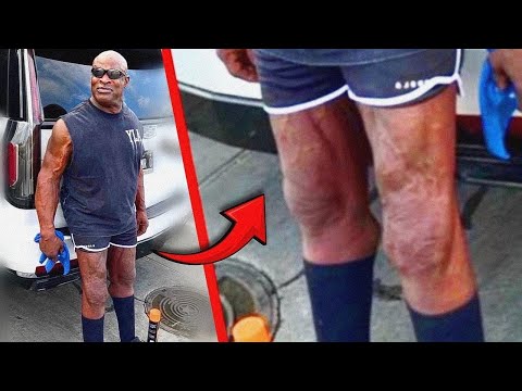 ¡¿QUÉ CAR4J0S PASÓ con LAS PIERNAS de RONNIE COLEMAN !?
