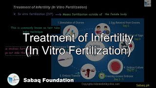 Treatment of Infertility (In Vitro Fertilization)