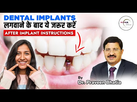 Dental IMPLANTS लगवाने के बाद ये ज़रूर करें | After Implant Care Tips in Hindi 🦷: Dr. Praveen Bhatia