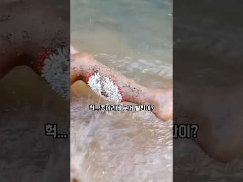 헉! 종아리에 문어 빨판이..? 대체 뭐야 이거!