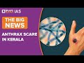 Anthrax: Symptoms, Treatment, and Prevention