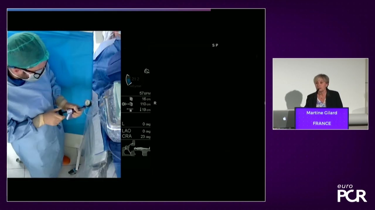 Robotic PCI: evolution
