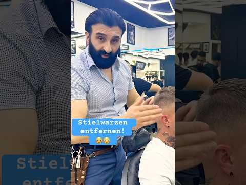 Stielwarzen entfernen!#foryoupage#fyp #kesfet#fürdich #viral_video #foryou #stuttgart #deutschland