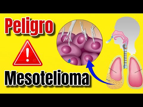 ¿Qué es el MESOTELIOMA CANCER y Cómo TRATARLO Benigno Maligno Difuso 2024