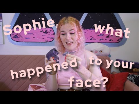 Sophie, what happened to your face?