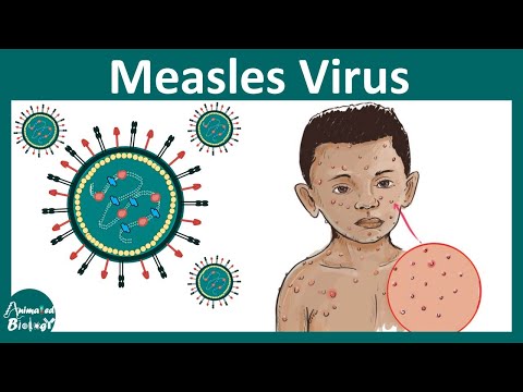 Measles virus | What is Measles  infection | Diagnosis and treatment of Measles