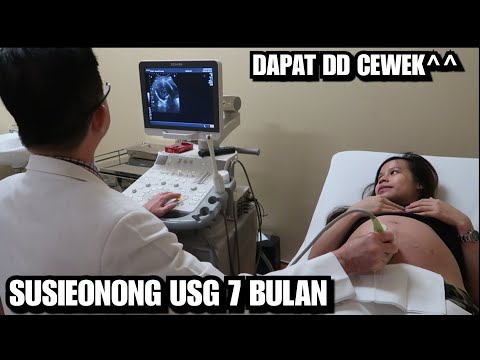 Download Video Susieonong Usg 7 Bulan | Dapat Dd Cewek Guys..doain Lancar Yah🤗 Download Video Susieonong Usg 7 Bulan | Dapat Dd Cewek Guys..doain Lancar Yah🤗