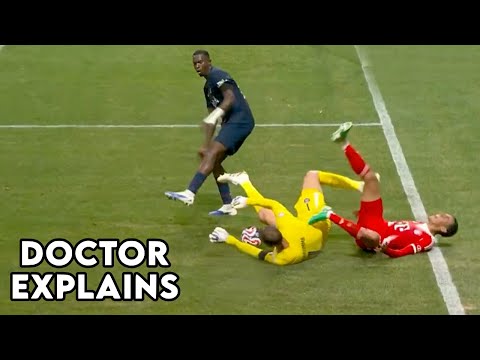 Jamal Musiala Severe Leg Injury - Doctor Explains