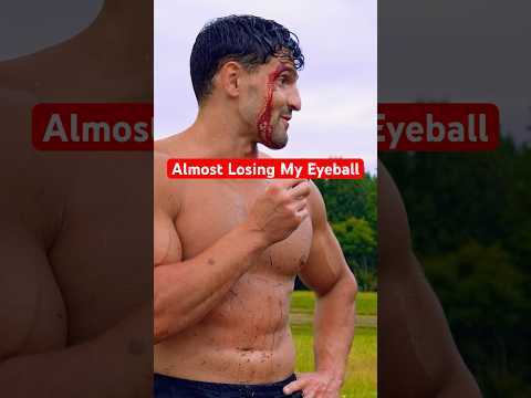 How I Almost Lost My Eyeball… #funny #scary #shorts