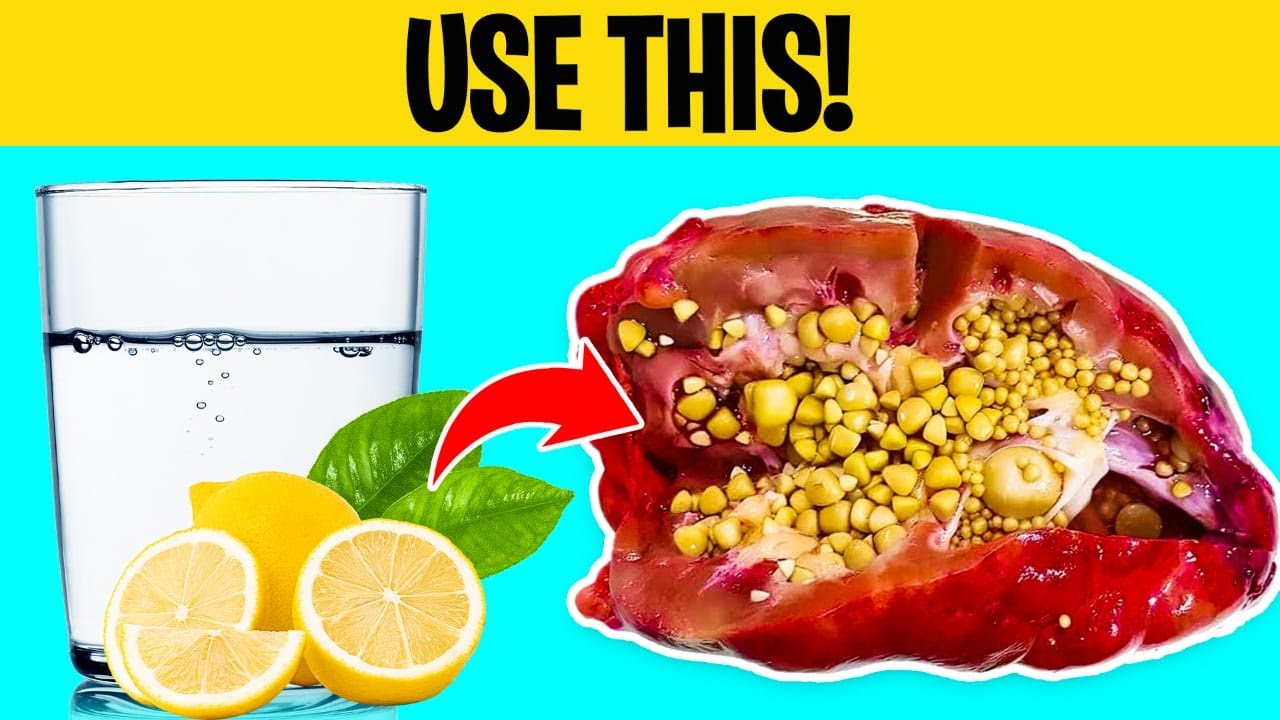 CLEAN Your KIDNEYS of URIC ACID & OXALATES, Here’s How