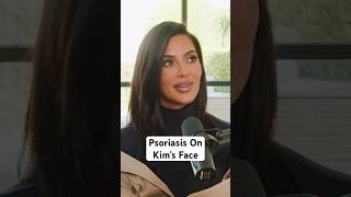 @KimKardashian’s Psoriasis Playbook and going to the Met. #psoriasis #psoriaticarthritis