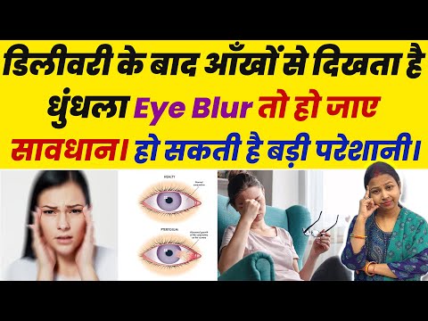 डिलीवरी के बाद आँखों से दिखता है धुंधला Blur तो हो जाए सावधान। After Delivery Eye Problems.