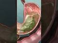 Understanding Stomach Acid and Its Protection