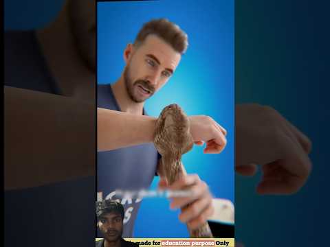 #tiktokeffects