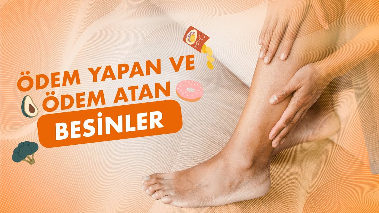 Ananas, Yeşil Çay ve Salatalık Ödem Atar mı? : Ödem Yapan ve Ödem Atan Besinler Nelerdir?