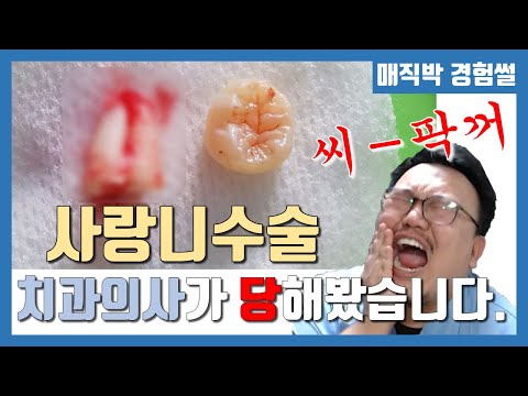 사랑니수술 치과의사가 당해보았습니다.