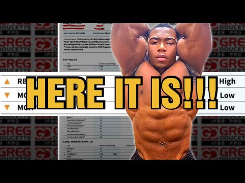 Julian Fitzgerald Natty Or Not || Blood Work Part 2
