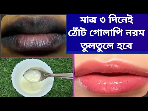 মাত্র তিন রাত কালো ঠোঁটের উপরে এটা লাগালে ঠোঁট হবে গোলাপি নরম, তুলতুলে//কালো ঠোঁট গোলাপি করার  উপায়