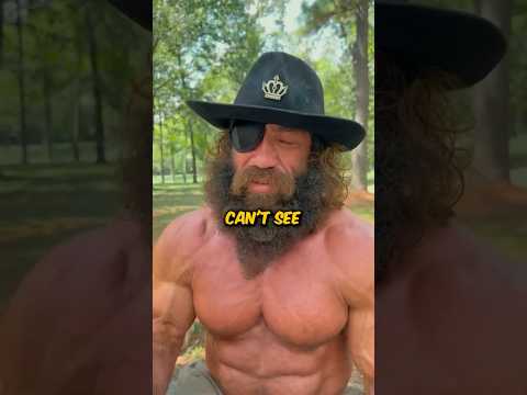 ?Exposed?: The liver king eye injury explained #shorts #bodybuilding #viral #liverking