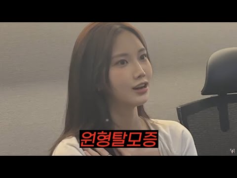 모델해야 하는데 탈모 진단 받았습니다..