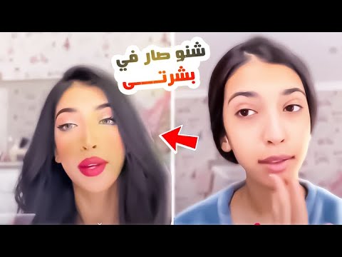 بعد التعب شوفو بشرتي شنو صار فيها😵 💫😭