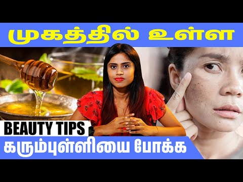 முகத்தில் உள்ள கரும்புள்ளியை போக்க… மோரை இப்படி பயன்படுத்திப் பாருங்க! |@HealthReel