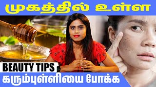 முகத்தில் உள்ள கரும்புள்ளியை போக்க… மோரை இப்படி பயன்படுத்திப் பாருங்க! |@HealthReel