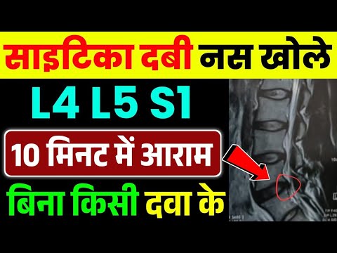 साइटिका और स्लिप डिस्क में तुरंत आराम|Sciatica Pain Relief Exercises|Sciatica Stretches Pain Relief