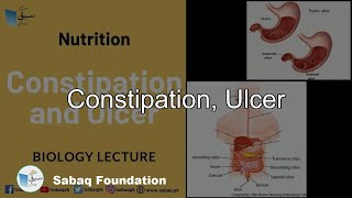 Constipation, Ulcer