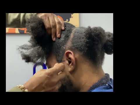 I TOLD Y'ALL HIS DANDRUFF IS GETTING MUCH BETTER! 2MUCHHAIR