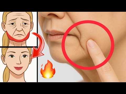 Push Here to Erase Marionette Lines in 8 Minutes 🔥Face Lifting Exercises for Droopy Mouth Corners