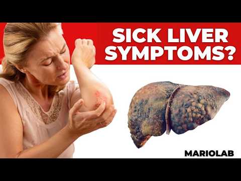 What are the clear symptoms of liver disease on the skin and legs?