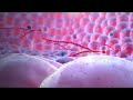 Ebola Virus Mechanisms and Effects