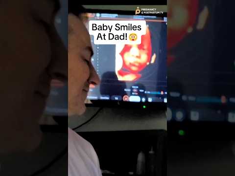 😭😭Baby Smiles At Dad During Ultrasound (ADORABLE 🥹)