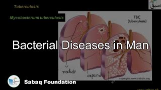 Bacterial Diseases in Man