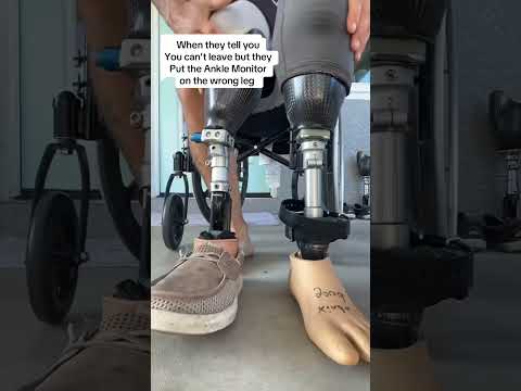 Life with an ankle monitor #amputee #funny #jokes #darkhumor #ankle #monitor