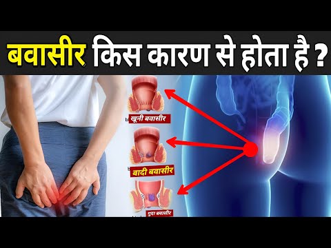 ये गलती की तो बवासीर हो जाएगा | Why Bawasir Happens | Bawasir Kyu Hota Hai In Hindi