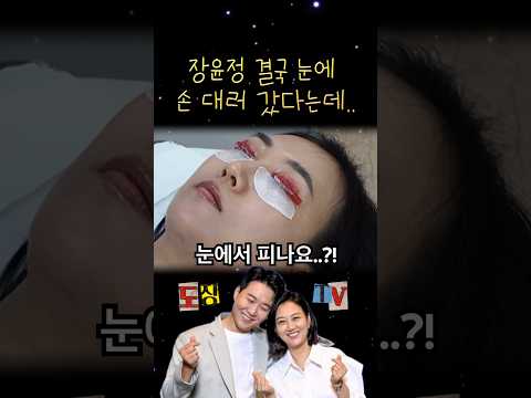 장윤정 결국 눈에 손대러 간 이유