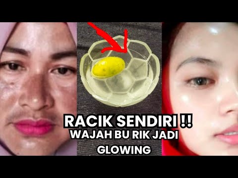 RACIK SENDIR! TANPA BANTUAN DOKTER!!  PELUNTUR PLEK HITAM, KULIT GOSONG JADI PUTIH  KINCLONG!!