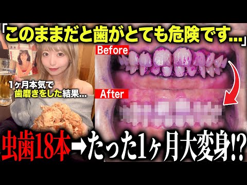 虫歯18本から始まったグラドルの1ヶ月歯磨き挑戦…驚きの結果に!?