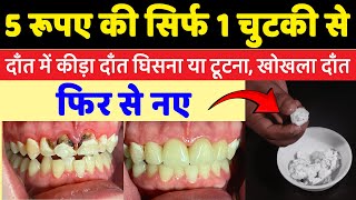 5 रुपये की सिर्फ़ 1 चुटकी से दाँत में कीड़ा दाँत घिसना या टूटना, खोखला दाँत फिर से नए Teeth ABS
