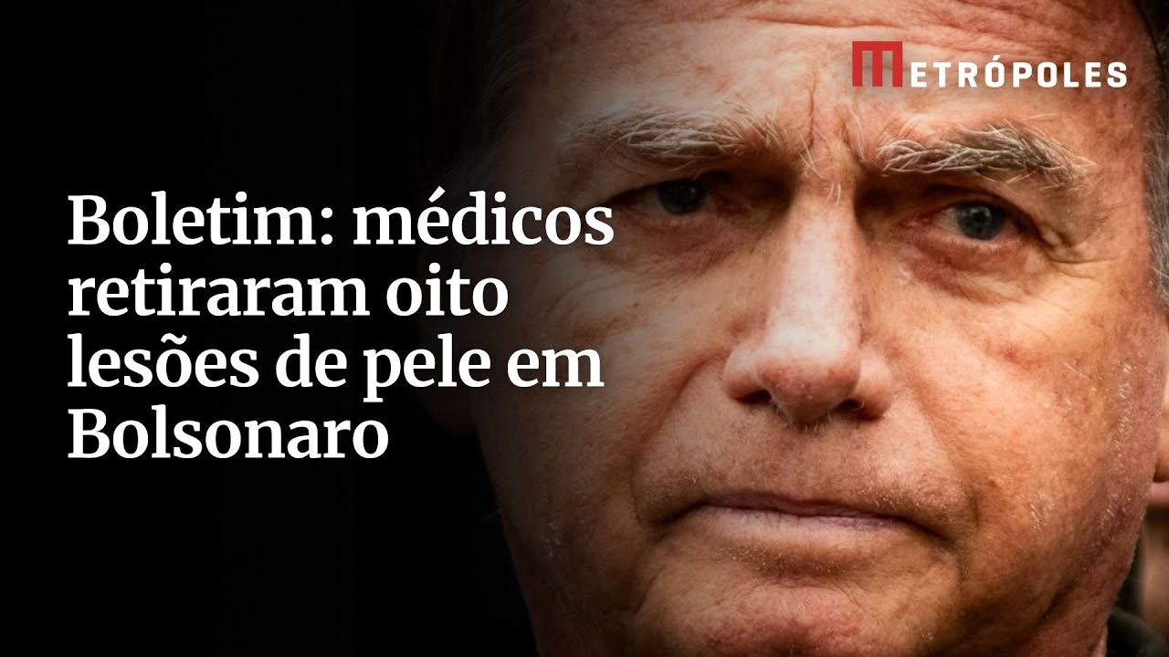 Boletim médicos retiraram oito lesões de pele em Bolsonaro