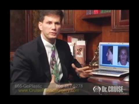 Doctor discussing cosmetic surgery with before-and-after photos.