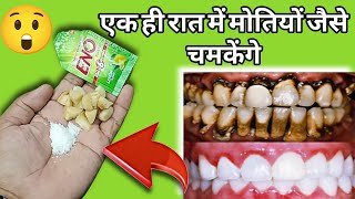 सिर्फ 3 रुपए में काले,पीले,खोखले दांत😬 भी चांदी जैसे चमकने लगेंगे।Peele Dant saaf karne ka tarika