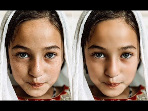 Fastest way to clean your face in photoshop-Remove pimples,blemishes,acne easily. #photoshop #shorts